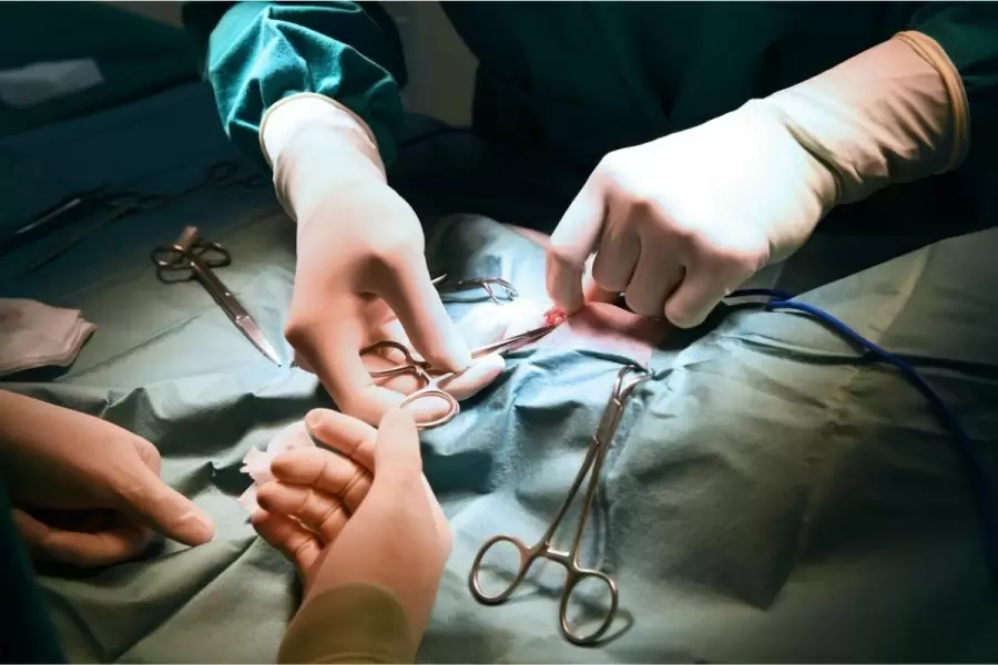 Operasi Asam Lambung, Atasi Masalah Langsung pada Sumbernya