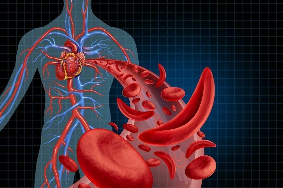 Gejala Kekurangan Vitamin B yang Sering Diabaikan: Kenali Tandanya Sejak Dini!