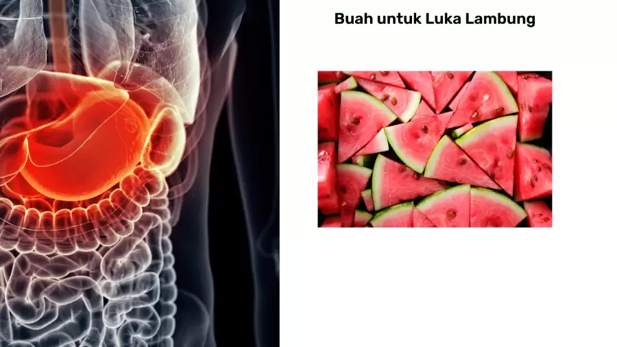 Rekomendasi Buah saat Lambung Luka