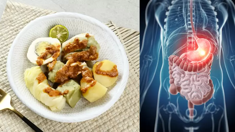 Bolehkah Makan Siomay Saat Asam Lambung? Panduan dan Tips Sehat